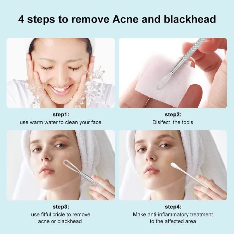 Vitality Aura Precision Blackhead Extractor