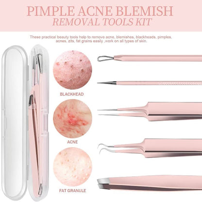 Vitality Aura Comedone Extractor Set